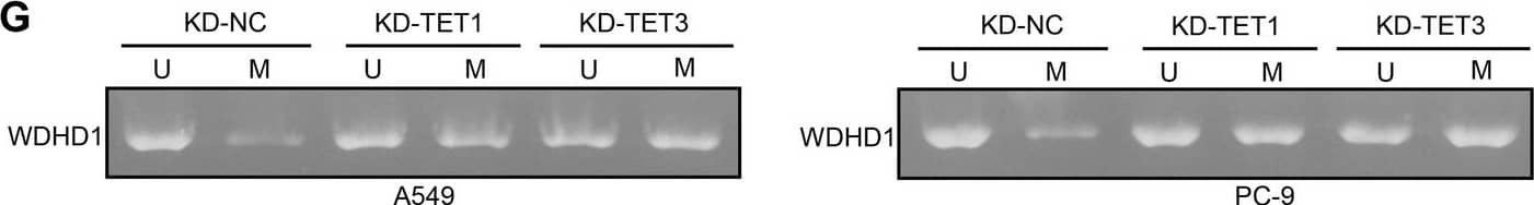 DNA demethylases TET1/TET3 activates WDHD1 in LUAD cells. (A) The level of WDHD1 promoter methylation in LUAD cells (H1944, A549, PC-9, and H1975 cells) and the human bronchial epithelial cell line (BEAS-2B) was examined using qMSP. (B) The protein expression of TET1, TET2, and TET3 in LUAD cells (H1944, A549, PC-9, and H1975 cells) and BEAS-2B cells was examined using western blot analysis. (C) The methylation of the WDHD1 promoter in tumors and paracancerous tissues of 16 LUAD patients was examined using qMSP. (D) The protein expression of TET1 and TET3 in tumors and paracancerous tissues of 16 LUAD patients was examined using western blot analysis. (E) Transcriptional levels of WDHD1, TET1, and TET3 in A549 and PC-9 cells after infection with KD-TET1 or KD-TET3 were examined using RT-qPCR. (F) The protein expression of WDHD1, TET1, and TET3 in LUAD cells after infection with KD-TET1 or KD-TET3 was examined using western blot analysis. (G) The level of WDHD1 promoter methylation in A549 and PC-9 cells after infection with KD-TET1 or KD-TET3 was examined using qMSP. p-values were calculated using paired t-tests or two-way ANOVA. Mean +/- SEM was presented. The average results from five independent experiments are shown Image collected and cropped by CiteAb from the following open publication (//respiratory-research.biomedcentral.com/articles/10.1186/s12931-025-03399-z), licensed under a CC-BY license. Not internally tested by Novus Biologicals.