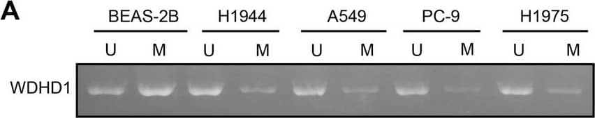 DNA demethylases TET1/TET3 activates WDHD1 in LUAD cells. (A) The level of WDHD1 promoter methylation in LUAD cells (H1944, A549, PC-9, and H1975 cells) and the human bronchial epithelial cell line (BEAS-2B) was examined using qMSP. (B) The protein expression of TET1, TET2, and TET3 in LUAD cells (H1944, A549, PC-9, and H1975 cells) and BEAS-2B cells was examined using western blot analysis. (C) The methylation of the WDHD1 promoter in tumors and paracancerous tissues of 16 LUAD patients was examined using qMSP. (D) The protein expression of TET1 and TET3 in tumors and paracancerous tissues of 16 LUAD patients was examined using western blot analysis. (E) Transcriptional levels of WDHD1, TET1, and TET3 in A549 and PC-9 cells after infection with KD-TET1 or KD-TET3 were examined using RT-qPCR. (F) The protein expression of WDHD1, TET1, and TET3 in LUAD cells after infection with KD-TET1 or KD-TET3 was examined using western blot analysis. (G) The level of WDHD1 promoter methylation in A549 and PC-9 cells after infection with KD-TET1 or KD-TET3 was examined using qMSP. p-values were calculated using paired t-tests or two-way ANOVA. Mean +/- SEM was presented. The average results from five independent experiments are shown Image collected and cropped by CiteAb from the following open publication (//respiratory-research.biomedcentral.com/articles/10.1186/s12931-025-03399-z), licensed under a CC-BY license. Not internally tested by Novus Biologicals.