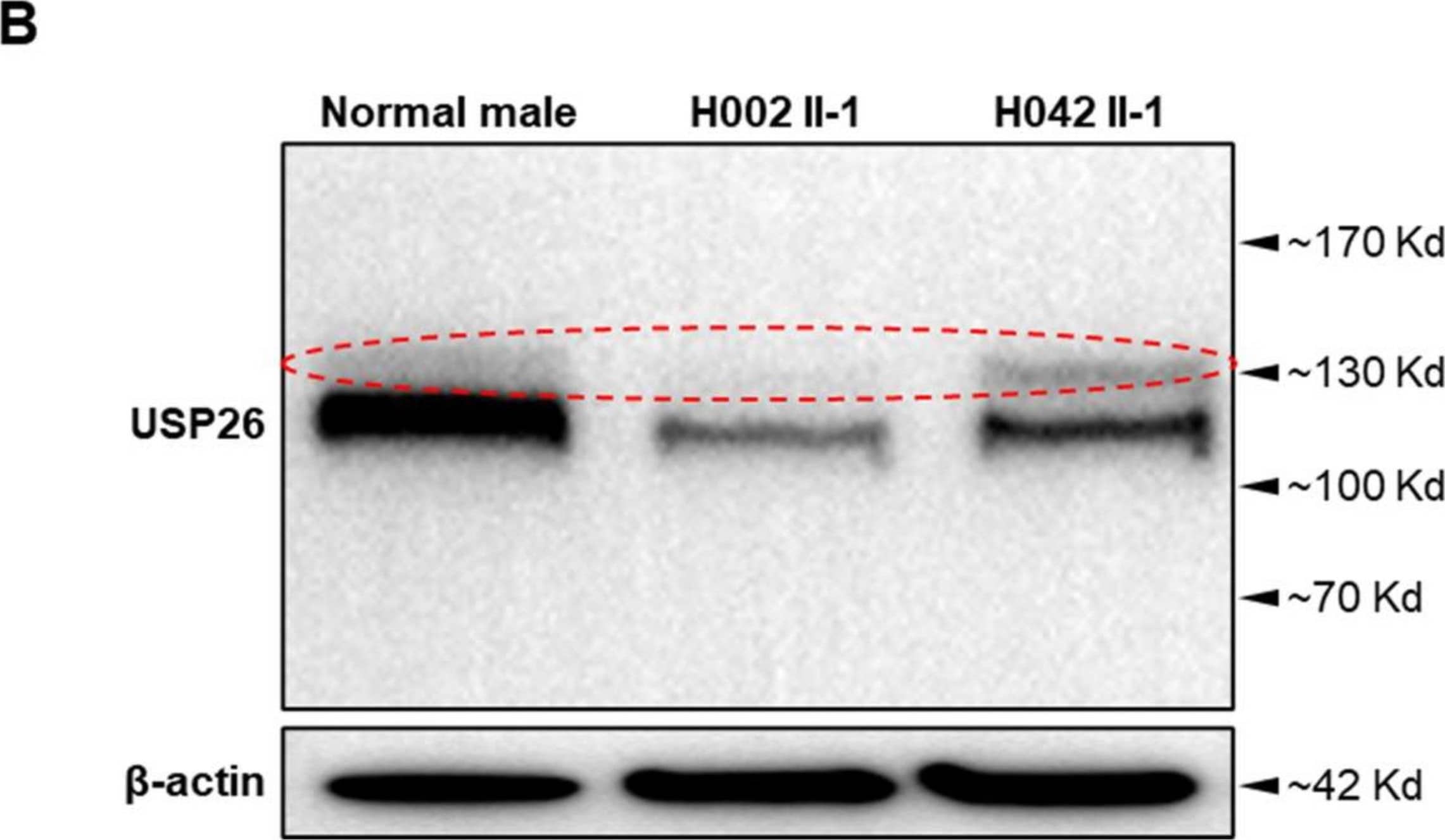 Western Blot USP26 Antibody - BSA Free
