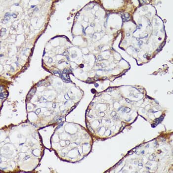 Immunohistochemistry: SLC7A2 Antibody - Azide and BSA Free [SLC7A2] - Immunohistochemistry analysis of paraffin-embedded Human placenta using SLC7A2 Rabbit pAb  at dilution of 1:100 (40x lens). Microwave antigen retrieval performed with 0.01M PBS Buffer (pH 7.2) prior to IHC staining.