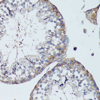 Immunohistochemistry: SLC7A2 Antibody - Azide and BSA Free [SLC7A2] - Immunohistochemistry analysis of paraffin-embedded Mouse testis using SLC7A2 Rabbit pAb  at dilution of 1:100 (40x lens). Microwave antigen retrieval performed with 0.01M PBS Buffer (pH 7.2) prior to IHC staining.