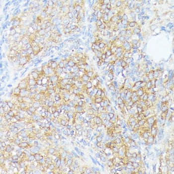 Immunohistochemistry: SLC7A2 Antibody - Azide and BSA Free [SLC7A2] - Immunohistochemistry analysis of paraffin-embedded Rat ovary using SLC7A2 Rabbit pAb  at dilution of 1:100 (40x lens). Microwave antigen retrieval performed with 0.01M PBS Buffer (pH 7.2) prior to IHC staining.