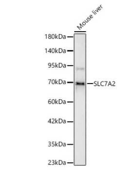 Western Blot: SLC7A2 Antibody [NBP2-93699] -  Analysis of lysates from Mouse liver using SLC7A2 Rabbit pAb at 1:1000 dilution.Secondary antibody:HRP Goat Anti-Rabbit IgG (H+L) at 1:10000 dilution.Lysates/proteins: 25 μg per lane.Blocking buffer: 3% nonfat dry milk in TBST.Detection:ECL Basic Kit. Exposuretime:10s.