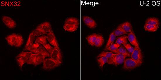 Immunocytochemistry/ Immunofluorescence Sorting Nexin 32 Antibody - BSA Free