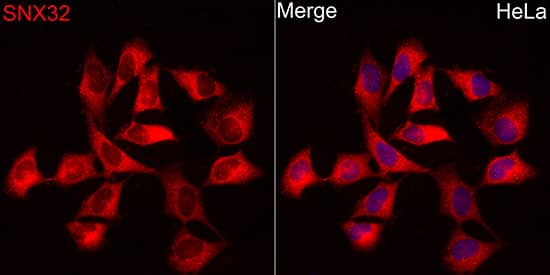 Immunocytochemistry/ Immunofluorescence: Sorting Nexin 32 Antibody - BSA Free [NBP2-93723] - Immunofluorescence analysis of HeLa cells using Sorting Nexin 32 Rabbit pAb (A8006) at dilution of 1:300 (40x lens). Secondary antibody: Cy3 Goat Anti-Rabbit IgG (H+L) (AS007) at 1:500 dilution. Blue: DAPI for nuclear staining.