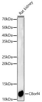 Western Blot: TC-1 Antibody [NBP2-93727] -Analysis of Rat kidney, using C8orf4 Rabbit pAb at 1:7000 dilution.Secondary antibody: HRP Goat Anti-Rabbit IgG (H+L) at 1:10000 dilution.Lysates/proteins: 25ug per lane. Blocking buffer: 3% nonfat dry milk in TBST.Detection: ECL Basic Kit. Exposure time: 180s.