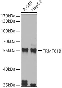 Western Blot: TRMT61B Antibody - BSA Free [NBP2-93769] - Western blot analysis of various lysates, using TRMT61B antibody (A8067) at 1:1000 dilution.Secondary antibody: HRP Goat Anti-Rabbit IgG (H+L) (AS014) at 1:10000 dilution.Lysates/proteins: 25μg per lane.Blocking buffer: 3% nonfat dry milk in TBST.Detection: ECL Basic Kit (RM00020).Exposure time: 5s.
