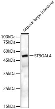 Western Blot: ST3GAL4 Antibody - BSA Free [NBP2-93783] - Western blot analysis of Mouse large intestine, using ST3GAL4 antibody (A6309) at 1:400 dilution.Secondary antibody: HRP Goat Anti-Rabbit IgG (H+L) (AS014) at 1:10000 dilution.Lysates/proteins: 25μg per lane.Blocking buffer: 3% nonfat dry milk in TBST.Detection: ECL Basic Kit (RM00020).Exposure time: 90s.