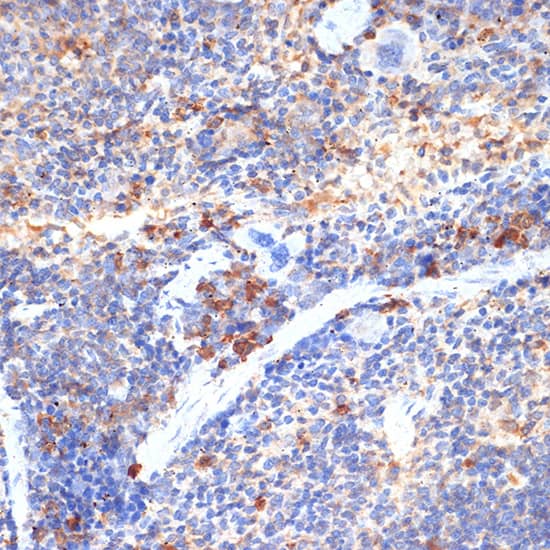 Immunohistochemistry: RB1CC1 Antibody - Azide and BSA Free [RB1CC1] - Immunohistochemistry analysis of paraffin-embedded mouse spleen using RB1CC1 Rabbit pAb  at dilution of 1:100 (40x lens).Perform microwave antigen retrieval with 10 mM Tris/EDTA buffer pH 9.0 before commencing with IHC staining protocol.