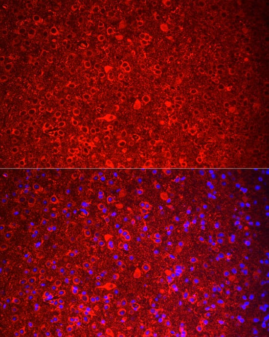 Immunocytochemistry/ Immunofluorescence: Neurokinin B Antibody - BSA Free [NBP2-93826] - Immunofluorescence analysis of mouse brain cells using Neurokinin B Rabbit pAb (A6312) at dilution of 1:100 (40x lens). Blue: DAPI for nuclear staining.