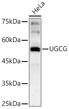 Western Blot: UGCG Antibody - BSA Free [NBP2-93827] - Western blot analysis of lysates from HeLa cells using UGCG Rabbit pAb(A6317) at 1:2000 dilution.Secondary antibody:HRP Goat Anti-Rabbit IgG (H+L)(AS014) at 1:10000 dilution.Lysates/proteins: 25 μg per lane.Blocking buffer: 3% nonfat dry milk in TBST.Detection:ECL Basic Kit (RM00020).Exposuretime:60s.