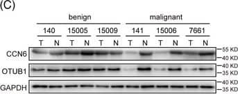 Western Blot WISP3 Antibody - Azide and BSA Free
