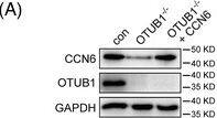 OTUB1 inhibits aggressive phenotypes of breast cancer cells in vitro. (A) Western blot analysis of CCN6, OTUB1 and GAPDH in control, OTUB1−/− and OTUB1−/− + CCN6 4T1 cells. Cell migration of different 4T1 cells was determined by (B) wound healing assay and (C) transwell migration assay (scale bar = 500 μm). Cell proliferation of different 4T1 cells was determined by crystal violet staining. Images were taken with (D) 1× and (E) 4× magnification (scale bar = 500 μm). (F) MTT assays were performed to assess the viability of different 4T1 cells (n = 3 for all groups) (mean +/- SEM, *p < .05). Image collected and cropped by CiteAb from the following open publication (//pubmed.ncbi.nlm.nih.gov/37608493), licensed under a CC-BY license. Not internally tested by Novus Biologicals.