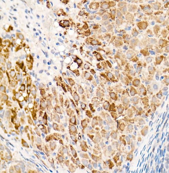 Immunohistochemistry-Paraffin: OGDH Antibody [NBP2-93877] - Rat ovary using OGDH Rabbit pAb at dilution of 1:20 (40x lens).Perform high pressure antigen retrieval with 10 mM citrate buffer pH 6.0 before commencing with IHC staining protocol.