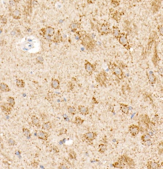 Immunohistochemistry-Paraffin: OGDH Antibody [NBP2-93877] -Rat brain using OGDH Rabbit pAb at dilution of 1:20 (40x lens).Perform high pressure antigen retrieval with 10 mM citrate buffer pH 6.0 before commencing with IHC staining protocol.