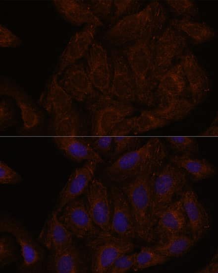 Immunocytochemistry/ Immunofluorescence Septin-8 Antibody - Azide and BSA Free