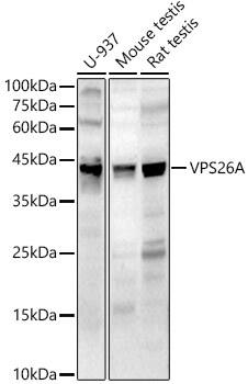 Western Blot: VPS26A Antibody - Azide and BSA Free [NBP2-93897] - Western blot analysis of various lysates, using VPS26A antibody (A14265) at  1:400 dilution.Secondary antibody: HRP Goat Anti-Rabbit IgG (H+L) (AS014) at 1:10000 dilution.Lysates/proteins: 25μg per lane.Blocking buffer: 3% nonfat dry milk in TBST.Detection: ECL Basic Kit (RM00020).Exposure time: 180s.