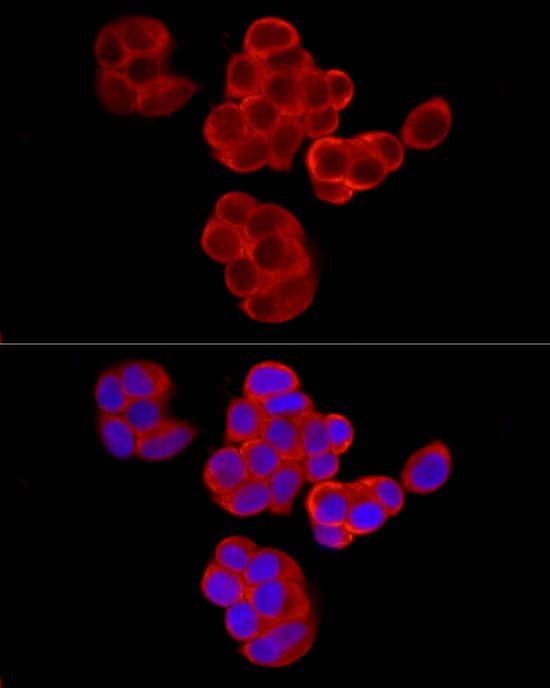 Immunocytochemistry/ Immunofluorescence: PABP Antibody - Azide and BSA Free [PABP] - Immunofluorescence analysis of MCF7 cells using PABP Rabbit pAb  at dilution of 1:100 (40x lens). Secondary antibody: Cy3-conjugated Goat anti-Rabbit IgG (H+L)  at 1:500 dilution. Blue: DAPI for nuclear staining.