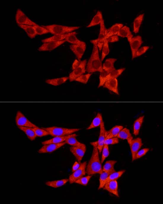 Immunocytochemistry/ Immunofluorescence: PABP Antibody - Azide and BSA Free [PABP] - Immunofluorescence analysis of PC-12 cells using PABP Rabbit pAb  at dilution of 1:100 (40x lens). Secondary antibody: Cy3-conjugated Goat anti-Rabbit IgG (H+L)  at 1:500 dilution. Blue: DAPI for nuclear staining.