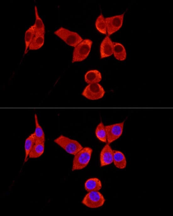 Immunocytochemistry/ Immunofluorescence: PABP Antibody - Azide and BSA Free [PABP] - Immunofluorescence analysis of NIH/3T3 cells using PABP Rabbit pAb  at dilution of 1:100 (40x lens). Secondary antibody: Cy3-conjugated Goat anti-Rabbit IgG (H+L)  at 1:500 dilution. Blue: DAPI for nuclear staining.