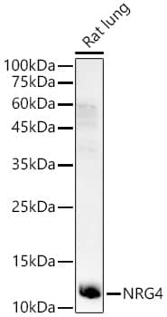 Western Blot: NRG4 Antibody - Azide and BSA Free [NRG4] - Western blot analysis of lysates from Rat lung, using NRG4 Rabbit pAb  at 1:1000 dilution.Secondary antibody: HRP-conjugated Goat anti-Rabbit IgG (H+L)  at 1:10000 dilution.Lysates/proteins: 25ug per lane.Blocking buffer: 3% nonfat dry milk in TBST.Detection: ECL Enhanced Kit .Exposure time: 60s.