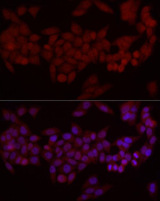 Immunocytochemistry/ Immunofluorescence: Smad7 Antibody - Azide and BSA Free [Smad7] - Immunofluorescence analysis of HeLa cells using Smad7 Rabbit pAb  at dilution of 1:50 (40x lens). Secondary antibody: Cy3-conjugated Goat anti-Rabbit IgG (H+L)  at 1:500 dilution. Blue: DAPI for nuclear staining.