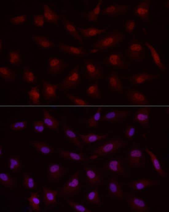 Immunocytochemistry/ Immunofluorescence: Smad7 Antibody - Azide and BSA Free [Smad7] - Immunofluorescence analysis of A-549 cells using Smad7 Rabbit pAb  at dilution of 1:50 (40x lens). Secondary antibody: Cy3-conjugated Goat anti-Rabbit IgG (H+L)  at 1:500 dilution. Blue: DAPI for nuclear staining.