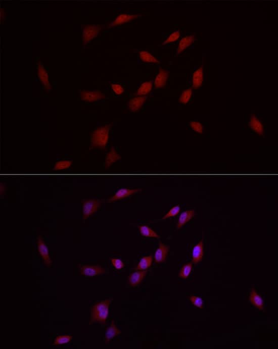 Immunocytochemistry/ Immunofluorescence: Smad7 Antibody - Azide and BSA Free [Smad7] - Immunofluorescence analysis of NIH/3T3 cells using Smad7 Rabbit pAb  at dilution of 1:50 (40x lens). Secondary antibody: Cy3-conjugated Goat anti-Rabbit IgG (H+L)  at 1:500 dilution. Blue: DAPI for nuclear staining.