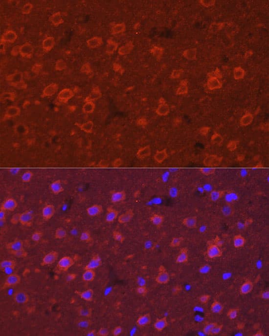 Immunocytochemistry/ Immunofluorescence SYT11 Antibody - Azide and BSA Free