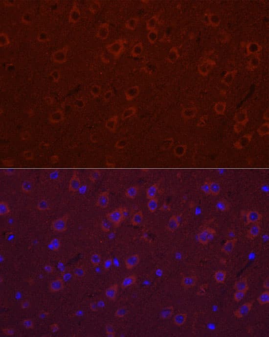 Immunocytochemistry/ Immunofluorescence SYT11 Antibody - Azide and BSA Free