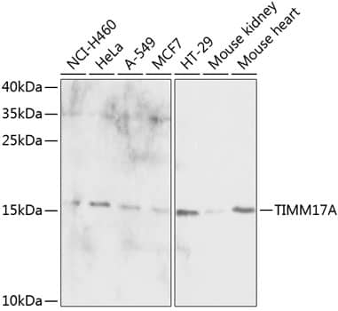 Western Blot: TIMM17A Antibody - BSA Free [TIMM17A] - Western blot analysis of various lysates using TIMM17A Rabbit pAb  at 1:1000 dilution.Secondary antibody: HRP-conjugated Goat anti-Rabbit IgG (H+L)  at 1:10000 dilution.Lysates/proteins: 25ug per lane.Blocking buffer: 3% nonfat dry milk in TBST.Detection: ECL Basic Kit .Exposure time: 30s.