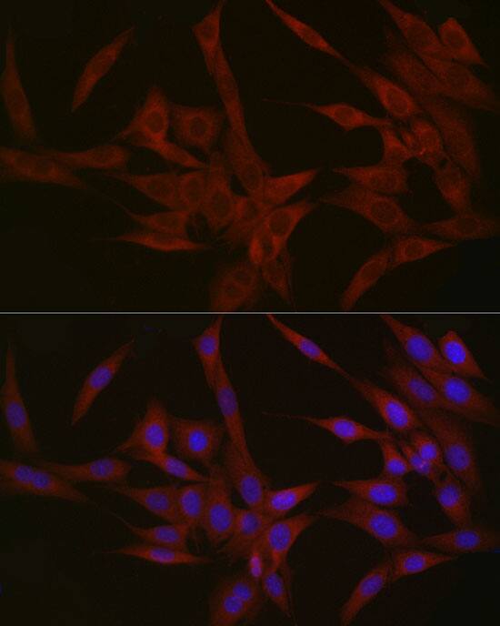 Immunocytochemistry/ Immunofluorescence: Nephronophthisis Antibody - Azide and BSA Free [Nephronophthisis] - Immunofluorescence analysis of NIH/3T3 cells using Nephronophthisis Rabbit pAb  at dilution of 1:50 (40x lens). Secondary antibody: Cy3-conjugated Goat anti-Rabbit IgG (H+L)  at 1:500 dilution. Blue: DAPI for nuclear staining.