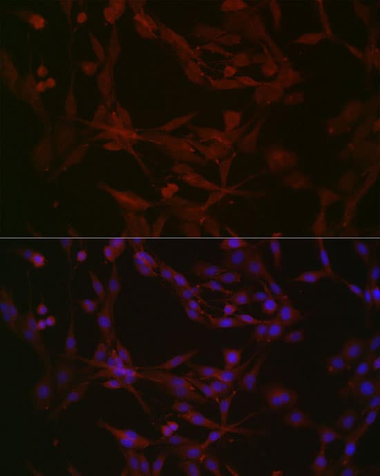 Immunocytochemistry/ Immunofluorescence: Nephronophthisis Antibody - Azide and BSA Free [Nephronophthisis] - Immunofluorescence analysis of PC-12 cells using Nephronophthisis Rabbit pAb  at dilution of 1:50 (40x lens). Secondary antibody: Cy3-conjugated Goat anti-Rabbit IgG (H+L)  at 1:500 dilution. Blue: DAPI for nuclear staining.