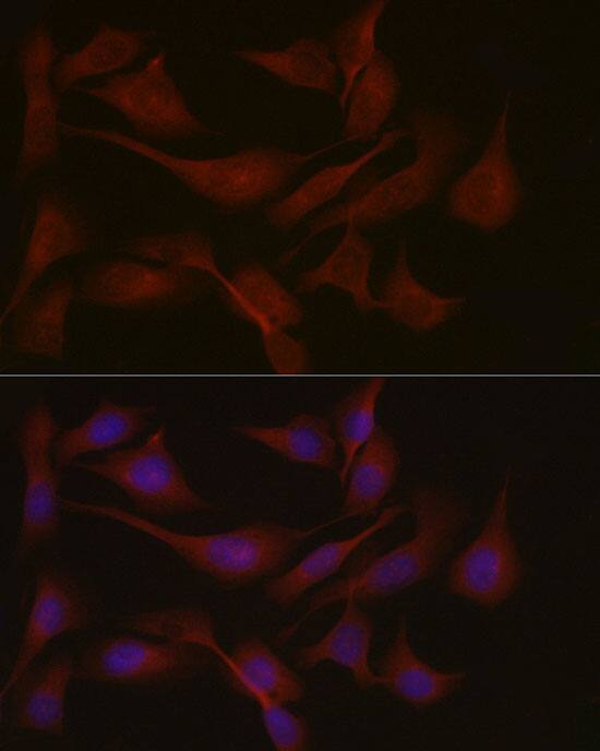 Immunocytochemistry/ Immunofluorescence: Nephronophthisis Antibody - Azide and BSA Free [Nephronophthisis] - Immunofluorescence analysis of U2OS cells using Nephronophthisis Rabbit pAb  at dilution of 1:50 (40x lens). Secondary antibody: Cy3-conjugated Goat anti-Rabbit IgG (H+L)  at 1:500 dilution. Blue: DAPI for nuclear staining.