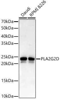 Western Blot: Phospholipase A2 IID Antibody - BSA Free [Phospholipase A2 IID] - Western blot analysis of various lysates, using Phospholipase A2 IID Rabbit pAb  at 1:400 dilution.Secondary antibody: HRP-conjugated Goat anti-Rabbit IgG (H+L)  at 1:10000 dilution.Lysates/proteins: 25ug per lane.Blocking buffer: 3% nonfat dry milk in TBST.Detection: ECL Enhanced Kit .Exposure time: 60s.