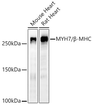 Western Blot: MYH7 Antibody - Azide and BSA Free [MYH7] - Western blot analysis of various lysates using MYH7 Rabbit pAb  at 1:500 dilution. Secondary antibody: HRP-conjugated Goat anti-Rabbit IgG (H+L)  at 1:10000 dilution. Lysates / proteins: 25 ug per lane. Blocking buffer: 3 % nonfat dry milk in TBST. Detection: ECL Basic Kit . Exposure time: 180s.