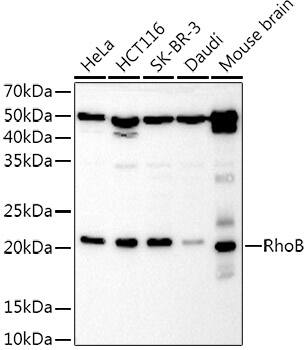 Western Blot: RhoB Antibody - Azide and BSA Free [NBP2-94104] - Western blot analysis of extracts of various cell lines, using RhoB Rabbit pAb antibody (A2819) at 1:1000 dilution.Secondary antibody: HRP Goat Anti-Rabbit IgG (H+L) (AS014) at 1:10000 dilution.Lysates/proteins: 25μg per lane.Blocking buffer: 3% nonfat dry milk in TBST.Detection: ECL Basic Kit (RM00020).Exposure time: 10s.