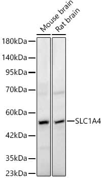 Western Blot: SLC1A4 Antibody - BSA Free [NBP2-94129] - Western blot analysis of various lysates, using SLC1A4 Rabbit pAb (A12507) at 1:2000 dilution.Secondary antibody: HRP Goat Anti-Rabbit IgG (H+L) (AS014) at 1:10000 dilution.Lysates/proteins: 25ug per lane.Blocking buffer: 3% nonfat dry milk in TBST.Detection: ECL Basic Kit (RM00020).Exposure time: 10s.
