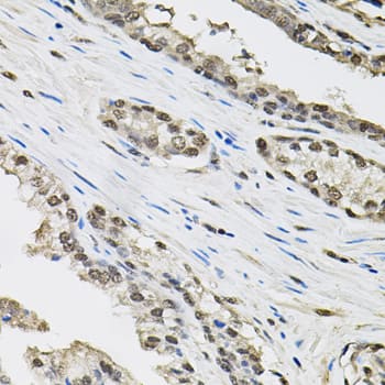 Immunohistochemistry: TCEB1 Antibody - BSA Free [TCEB1] - Immunohistochemistry analysis of paraffin-embedded Human prostate using TCEB1 Rabbit pAb  (40x lens). Microwave antigen retrieval performed with 0.01M PBS Buffer (pH 7.2) prior to IHC staining.