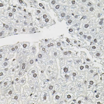 Immunohistochemistry: TCEB1 Antibody - BSA Free [TCEB1] - Immunohistochemistry analysis of paraffin-embedded Mouse liver using TCEB1 Rabbit pAb  (40x lens). Microwave antigen retrieval performed with 0.01M PBS Buffer (pH 7.2) prior to IHC staining.