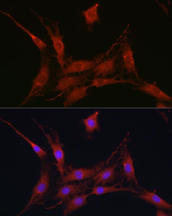 Immunocytochemistry/ Immunofluorescence: SLC4A4 Antibody - Azide and BSA Free [SLC4A4] - Immunofluorescence analysis of C6 cells using SLC4A4 Rabbit pAb  at dilution of 1:100 (40x lens). Secondary antibody: Cy3-conjugated Goat anti-Rabbit IgG (H+L)  at 1:500 dilution. Blue: DAPI for nuclear staining.