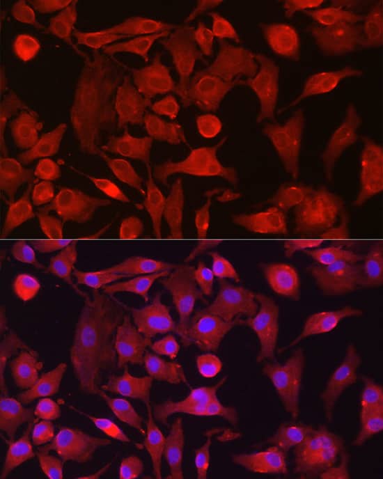 Immunocytochemistry/ Immunofluorescence: Rasgrp1 Antibody - BSA Free [NBP2-94157] - Immunofluorescence analysis of A-549 cells using Rasgrp1 Rabbit pAb (A10495) at dilution of 1:100 (40x lens). Secondary antibody: Cy3 Goat Anti-Rabbit IgG (H+L) (AS007) at 1:500 dilution. Blue: DAPI for nuclear staining.