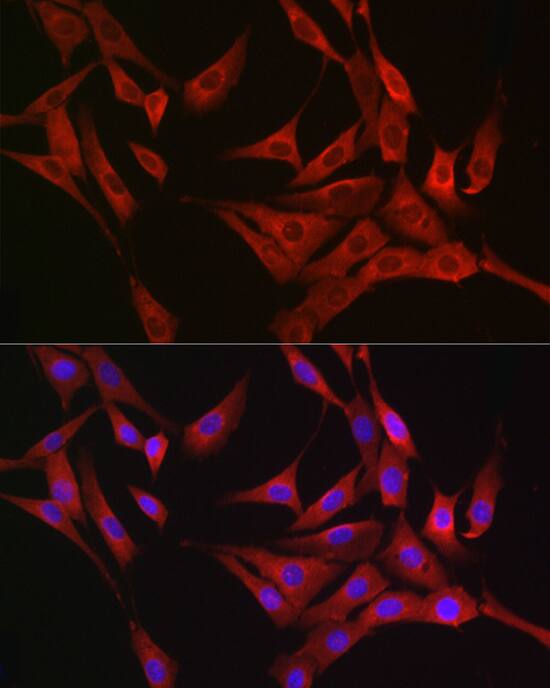 Immunocytochemistry/ Immunofluorescence Rasgrp1 Antibody - BSA Free