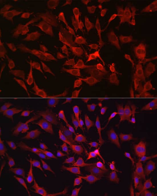 Immunocytochemistry/ Immunofluorescence Rasgrp1 Antibody - BSA Free