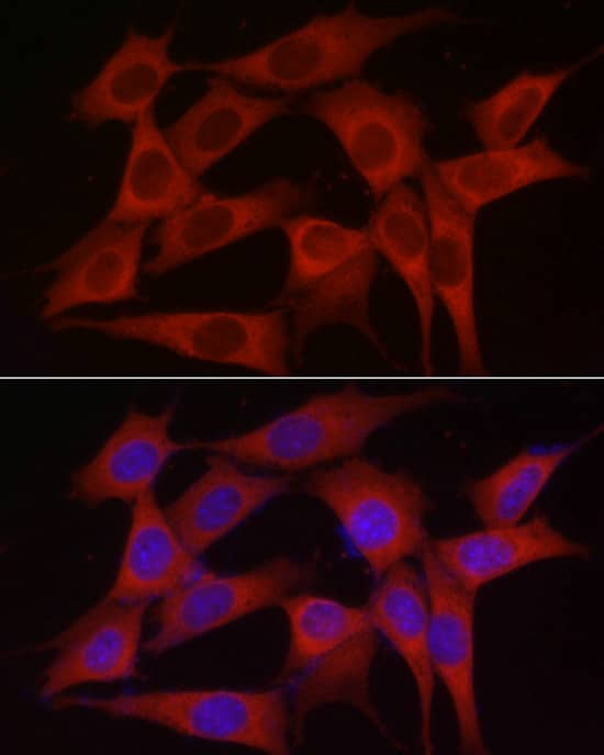 Immunocytochemistry/ Immunofluorescence: SKIP Antibody - BSA Free [NBP2-94173] - Immunofluorescence analysis of NIH/3T3 cells using SKIP Rabbit pAb (A7807) at dilution of 1:100 (40x lens). Secondary antibody: Cy3 Goat Anti-Rabbit IgG (H+L) (AS007) at 1:500 dilution. Blue: DAPI for nuclear staining.