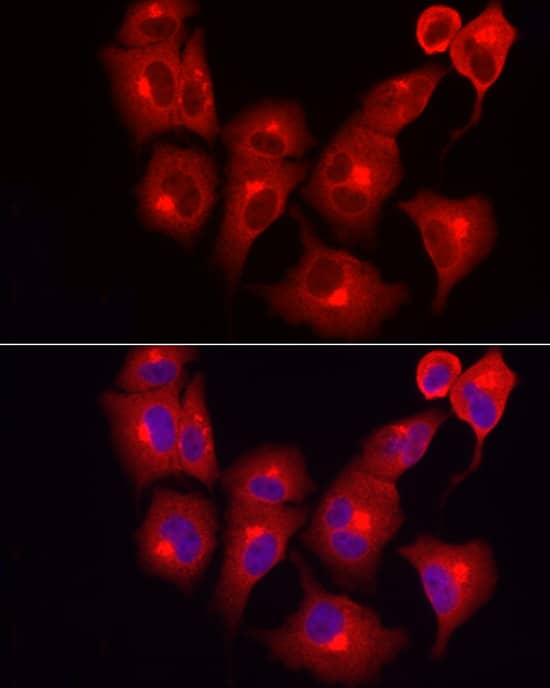 Immunocytochemistry/ Immunofluorescence: SKIP Antibody - BSA Free [NBP2-94173] - Immunofluorescence analysis of A-549 cells using SKIP Rabbit pAb (A7807) at dilution of 1:100 (40x lens). Secondary antibody: Cy3 Goat Anti-Rabbit IgG (H+L) (AS007) at 1:500 dilution. Blue: DAPI for nuclear staining.