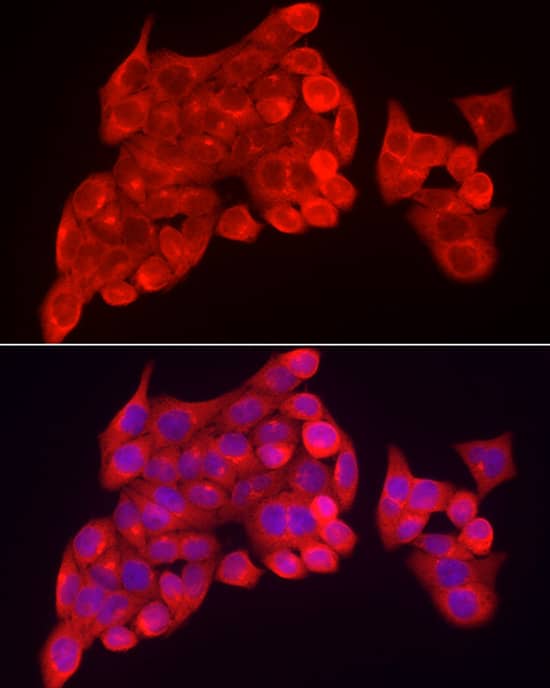 Immunocytochemistry/ Immunofluorescence: SKIP Antibody - BSA Free [NBP2-94173] - Immunofluorescence analysis of HeLa cells using SKIP Rabbit pAb (A7807) at dilution of 1:100 (40x lens). Secondary antibody: Cy3 Goat Anti-Rabbit IgG (H+L) (AS007) at 1:500 dilution. Blue: DAPI for nuclear staining.