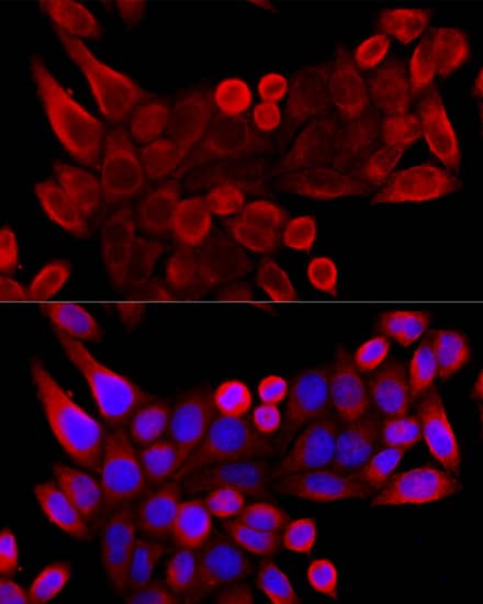 Immunocytochemistry/ Immunofluorescence: VDAC3 Antibody - Azide and BSA Free [VDAC3] - Immunofluorescence analysis of HeLa cells using VDAC3 Rabbit pAb  at dilution of 1:100 (40x lens). Secondary antibody: Cy3 Goat Anti-Rabbit IgG (H+L)  at 1:500 dilution. Blue: DAPI for nuclear staining.