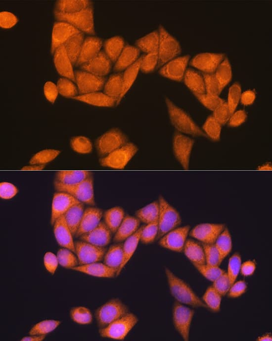Immunocytochemistry/ Immunofluorescence: RAP1B Antibody - Azide and BSA Free [NBP2-94183] - Immunofluorescence analysis of HeLa cells using RAP1B Rabbit pAb (A12925) at dilution of 1:100 (40x lens). Secondary antibody: Cy3 Goat Anti-Rabbit IgG (H+L) (AS007) at 1:500 dilution. Blue: DAPI for nuclear staining.