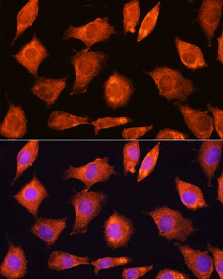 Immunocytochemistry/ Immunofluorescence SPC18 Antibody - Azide and BSA Free